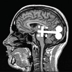ThotBot+Implantation+Center+TUE+12/9/25